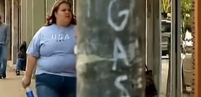 Excess weight - cause of varicose veins