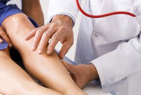 Varicose veins on their feet